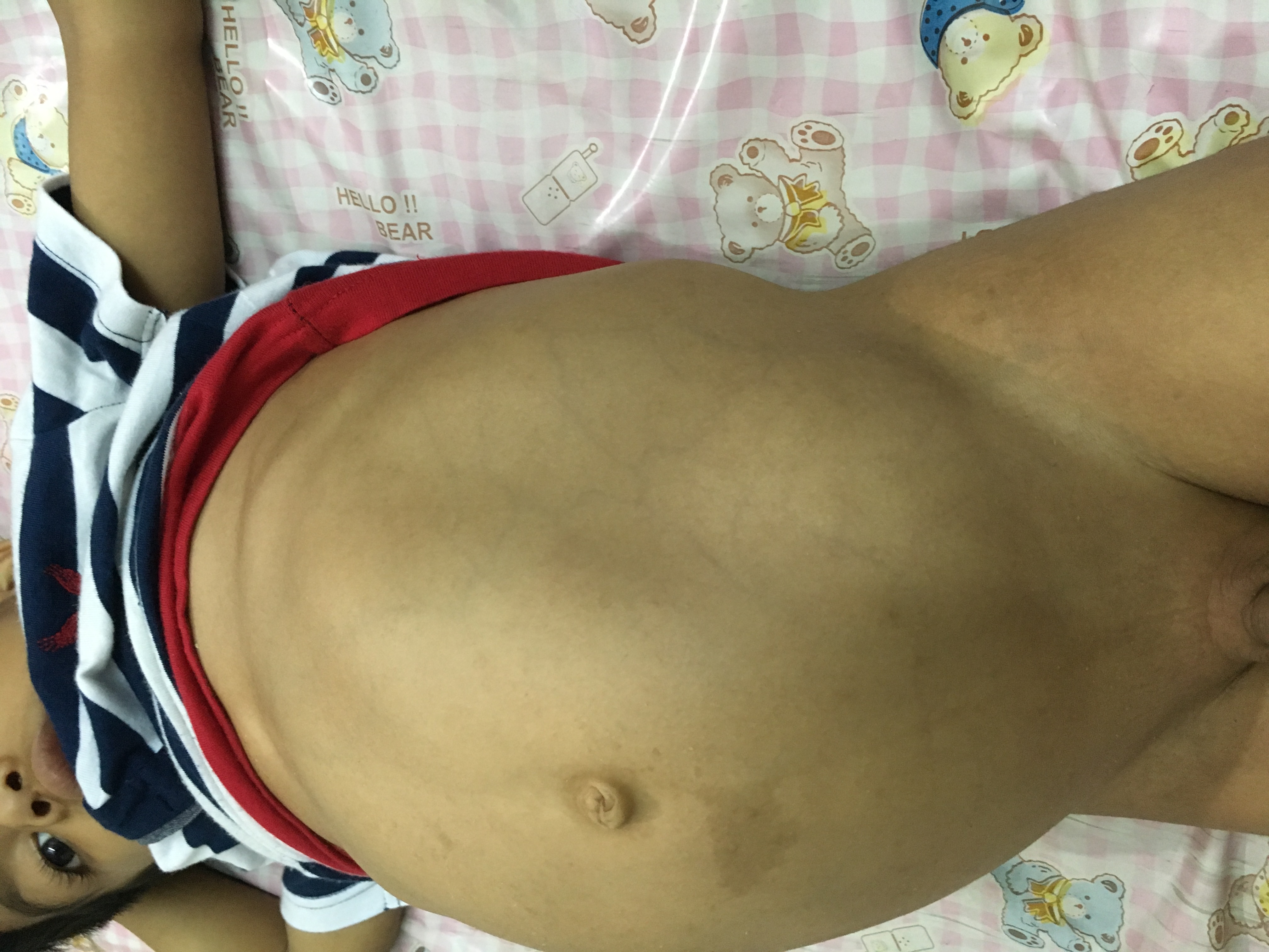 Pediatric G.I. Surgery Image 10